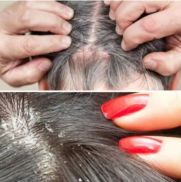 DERMA X ONARICI LOSYON (KEPEK)